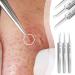 Ultra-fine No. 5 Cell Pimples Blackhead Clip Tweezers Acne Needle Blackhead Remover Kit Blackhead Remover Tweezers Black Dots Pore Cleaner Acne Needle Tool - Buy Online on GoSupps.com