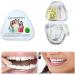 Flipped Warm 1 Par Artificial Tooth Veneer - Snap-On False Teeth for Perfect Smile | Cosmetic Denture Solutions - Buy Online on GoSupps.com