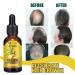 1/2/3pcs Hair Growth Serum Hair Growth Serum Natural Hair Growth Essence Contains Ginseng Promotes Natural Hair Growth (3pcs) - Buy Online on GoSupps.com