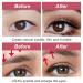 Buy Invisible Double Eyelid Tapes - Waterproof & Long-Lasting 600PC | Eyelid Lifting Without Surgery - Buy Online on GoSupps.com