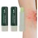 Itch stick Natural itch eraser Bite stick for all skin types itch relief pen gift for mothers friends soothes sunburn and minor skin irritation Bexdug - Buy Online on GoSupps.com