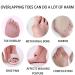 Toe Separator 6 PCS - Bunion Corrector Spacers for Men & Women | Restore Toe Shape - Blue - Buy Online on GoSupps.com