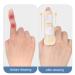 YiYLunneo Adjustable Finger Strap - Corrector for Sprains Dislocations & Fractures | International Shipping Available - Buy Online on GoSupps.com