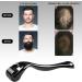 Xyemao Beard Growth Roller| Derma Roller 3Pack (0.25+0.5+1.0) mm | Beard Roller | Titanium Micro Needling Roller for Men and Women | Stimulate Beard and Hair Growth - Black 3 Piece Assortment - Buy Online on GoSupps.com
