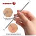 Ellolife 5-Pack Blackhead Remover Set - Stainless Steel Comedone Squeezer Kit for All Skin Types | Acne and Whitehead Extraction - Buy Online on GoSupps.com