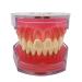 Standard Teeth Model Dental Crown Models Soft Gums Dental Model Resin Removable Full Mouth Teeth for Tooth Extraction Exercises Doctor Explains to The Patient