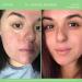 Buy Rodan and Fields Soothe Regimen - Best for Sensitive Irritated Skin & Facial Redness | International Shipping Available - Buy Online on GoSupps.com