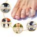 10 Pieces Pinky Toe Spacers - Cushions for Overlapping Toes | Comfort & Relief for Women & Men - Buy Online on GoSupps.com