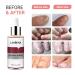 LANBENA Nail Repair Essence - Nail Repair Treatment for Damaged Nails - Protect, Cure and Restore Your Nails - 12ml - Buy Online on GoSupps.com