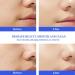 Aqua Peeling Solution for SPA Salon 3 Bottle 400ml Skin Care Aqua Peel Serum Small Bubble Solution Hydro Facial Machine Solution for Cleaning Face - Buy Online on GoSupps.com