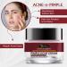 Riffway Pimple Cream & Acne Moisturizing Gel for All Skin Types | Soothing Glowing Skin No Side Effects - Shop Internationally - Buy Online on GoSupps.com