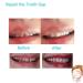 Temporary Tooth Repair Kit for Instant Smile Confidence - Moldable Thermal Fitting Beads for Denture Adhesive, Cosmetic Braces, Veneer - Snap-On Fake Teeth - Buy Online on GoSupps.com