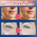 Akissos Forehead Wrinkle Patches - Non-Invasive Smoothers for Forehead Wrinkles - 5cm*5m Roll - Buy Online on GoSupps.com