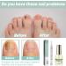 2 pi ces Stylo de Soin des Ongles+vernis poderm mycose ongle pied Traitement Mycose Ongle des Pied Puissant R paration Des Ongles Renforce et Revitalise Les Ongles Huile De Th ier et Romarin - Buy Online on GoSupps.com