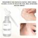 S rum la niacinamide - Essence hydratante pour le visage - 10 % niacinamide + 1 % de zinc - Convient pour tous les types de peau - 30 ml - Buy Online on GoSupps.com
