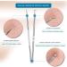 Blackhead Remover Kit Extractor Removal Set Professional Stainless Steel Pimple Popper Tool Treatment for Whitehead Blemish Acne Comedone Pimple Popping (Silver) - Buy Online on GoSupps.com