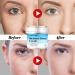 Lagunamoon Hyaluronic Acid Face Moisturizer for Women - Hydrating & Soothing Face Cream | Oil-Free, Fragrance-Free, Non-Comedogenic - 75g/2.64 oz - Buy Online on GoSupps.com