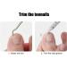Toenail Clippers Stainless Steel Double Spring Straight Blade Toenail Nipper with Toenail Lifter for Foot Nail Treatment for Seniors for Thick Toenails - Buy Online on GoSupps.com