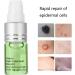 Mole Removal Cream Pigment Repair Gel Melanin Spot Corrector Cream Crea for Skin Brightening & Pigment Removal Dark Spot Recovery Solution - Buy Online on GoSupps.com