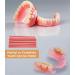 Denture Material Kit | DIY Full Denture Repair for Missing Teeth - International Shipping Available - Buy Online on GoSupps.com