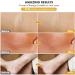 Silicone Scar Strips 1.6 x 6 Multi-Use Cream 8 Pcs - Reusable Scar Sheets for Scar Removal - 4 Month Supply - Buy Online on GoSupps.com