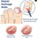 German Toenailcare Removal Paronychia Oil Care Oil for Removing Paronychia Toenail Treatment Best Nail Repair Solution Nail Renewal Liquid for Damaged & Discoloration Nail (3pcs) - Buy Online on GoSupps.com
