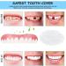 Clip-In Veneers Teeth | 2 Pairs Snap-On Prosthetic Solutions for Men & Women - Buy Online on GoSupps.com