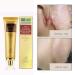 Symeas Scar & Acne Removal Cream - Effective Treatment for Stretch Marks Keloid Skin & Burns - 30g - Buy Online on GoSupps.com