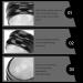 Ultechnovo Massage Ball Roller for Face & Body Essential Oil Resined Muscle Massager & Ice Massage Fascia Ball for Pain Relief - Buy Online on GoSupps.com