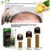  HADAVAKA Ginger Hair Growth Serum Hair Regrowth Spray Hair Growth Essential Oils Hair Serum Hair Nutrient Liquid Hair Conditioning Essential Oils Hair Growth Spray For Hair Care (1 pc) - Buy Online on GoSupps.com