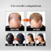Hair Growth Oil | Daily Hair Care Treatment Hair Oil Care 5ml x 3 Set of Plant-Based Hair Growth Oil Moisturizing Nourishing the Scalp Contains - Buy Online on GoSupps.com