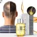 BOKIOESDE Ginger Hair Growth Prevent Hair-Loss Essential Oil Nutrient Solution Fast Growing Scalp Beauty Health Men - Buy Online on GoSupps.com
