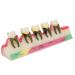 Model for dental periodontitis dental periodontal development model tooth disease study learning model for dental studies and research