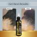 Premium Rapid Growth Hair Oil 100ml - Enhance Volume & Shine | Black & Gold - International Shipping Available - Buy Online on GoSupps.com