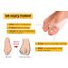 USFOOT 100% Silicon Gel Bunion Spreader & Corrector - Hallux Valgus Relief (Small 1 Pair - Buy Online on GoSupps.com