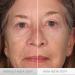 Serious Skincare INSTA-TOX Facial Firming Serum & Reverse Lift Eye Cream Bundle - Buy Online on GoSupps.com