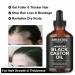 Jamaican Black Castor Oil - Pure Cold Pressed for Hair Growth Eyelash & Eyebrow Care Body Massage & Nail Moisturizing - Organic International Shipping - Buy Online on GoSupps.com