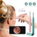 JYYBN Smart Ear Wax Removal Tool Camera | Wireless Ear Otoscope with 6 LED Lights | Waterproof Ear Cleaning Kit for Adults Children Pets - Green - Buy Online on GoSupps.com