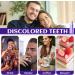 Lyppul 3pcs Purple Teeth Whitening Toothpaste 30ml Purple Formula for Brighter Whiter Teeth | Effective Yellow Stain Removal - Buy Online on GoSupps.com