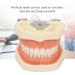 Buy Dental Typodont Teeth Model - 28 Teeth Soft Gums Upper Jaw Cyst Teaching Model for Incision Practice - International Shipping Available - Buy Online on GoSupps.com
