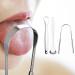 Premium Stainless Steel Tongue Brush & Scraper | Mundsmanger U-Shaped Tongue Cleaner for Effective Oral Hygiene - Buy Online on GoSupps.com