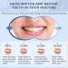 Maycharm Reduced Sensitivity Teeth Whitening Strips - Enamel Safe & Harm-Free (14 Strips) - Buy Online on GoSupps.com