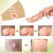 Corn Removal Pads - 24pcs Corn Remover Treatment for Painful Corns and Calluses - Buy Online on GoSupps.com