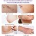 AICHUN BEAUTY Lavender Extract Scar Repair Essence | Anti-Scar Essential Oil for Smooth Skin | 30ml - Buy Online on GoSupps.com