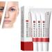 SGHOPLG 3Pcs Effective Whitening Freckle CreamRemove Melasma Acne Cream Fading Spot CreamAcne Scar Removal TreatmentFade Pigmentation Anti Melasma Brighten Skin Care Creams