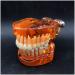 Transparent Dental Model for Adult Dentists | Realistic Teeth & Gums for Teaching & Demonstration - International Shipping - Buy Online on GoSupps.com