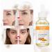 Buy Turmeric Serum for Dark Spots - Facial & Body Corrector Acne Treatment Pure Turmeric Oil Skincare for All Skin Types - Buy Online on GoSupps.com