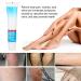 Varicose Vein Treatment Cream - Reduce Inflammation, Improve Circulation | Vein Lotion for Legs & Body - Buy Online on GoSupps.com