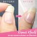5ml Instant Cracked Nail Repair Gel - Nail Strengthener & Phototherapy Glue - Restore Weak, Broken, & Damaged Nails - Fast Fix for Nail Cracks - 1pc - Buy Online on GoSupps.com