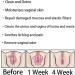 AnnieCare PRO Itching Stopper & Detox Capsules - 2 Box Set - Buy Online on GoSupps.com